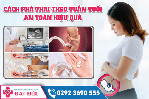 Cách Phá Thai Theo Tuần Tuổi An Toàn Hiệu Quả