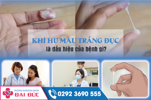 Khí hư màu trắng đục là dấu hiệu của bệnh gì?